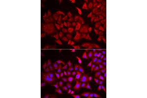 Immunofluorescence analysis of HeLa cells using TARS antibody (ABIN5974207). (TARS antibody)