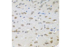 Immunohistochemistry of paraffin-embedded rat brain using TRPC1 antibody (ABIN6003660) (40x lens).