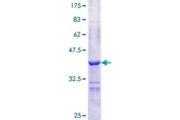 PLIN1 Protein (AA 101-208) (GST tag)