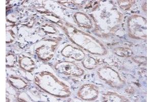 Immunohistochemistry of paraffin-embedded human kidney tissue using ABIN7153940 at dilution of 1:100 (PRKCSH antibody  (AA 15-302))
