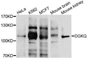 Western blot analysis of extracts of various cells, using DGKQ antibody. (DGKQ antibody)