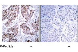 Image no. 2 for anti-Epidermal Growth Factor Receptor (EGFR) (pTyr1092) antibody (ABIN196761) (EGFR antibody  (pTyr1092))