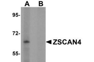 Western blot analysis of ZSCAN4 in mouse lung tissue lysate with AP31008PU-N in (A) the absence and (B) presence of peptide blocking. (ZSCAN4 antibody  (C-Term))