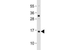 Western blot testing of human HaCaT cell lysate with TCTA antibody at 1:2000.