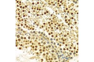 Immunohistochemistry of paraffin-embedded Rat testis using MYSM1 antibody at dilution of 1:100 (x400 lens). (MYSM1 antibody  (C-Term))