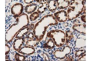 Immunohistochemical staining of paraffin-embedded Human Kidney tissue using anti-MMAB mouse monoclonal antibody.
