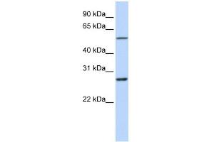 RNF217 antibody used at 1 ug/ml to detect target protein. (RNF217 antibody  (Middle Region))