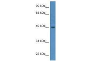 Image no. 1 for anti-ELMO/CED-12 Domain Containing 3 (ELMOD3) (AA 238-287) antibody (ABIN6746825) (ELMOD3 antibody  (AA 238-287))