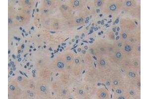 Immunohistochemistry (IHC) image for anti-Phosphoinositide-3-Kinase, Class 3 (PIK3C3) (AA 631-885) antibody (ABIN7443278)