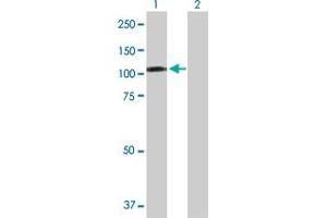 Western Blot analysis of CBL expression in transfected 293T cell line by CBL MaxPab polyclonal antibody. (CBL antibody  (AA 1-906))