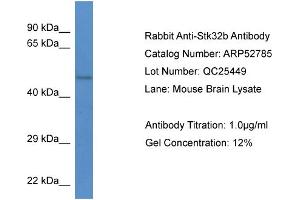 Western Blotting (WB) image for anti-serine/threonine Kinase 32B (STK32B) (N-Term) antibody (ABIN2785092) (STK32B antibody  (N-Term))