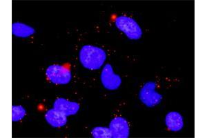 Proximity Ligation Assay (PLA) image for anti-Protein Phosphatase, Mg2+/Mn2+ Dependent, 1B (PPM1B) (AA 1-192) antibody (ABIN562341)