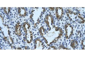 Rabbit Anti-KRT8 Antibody       Paraffin Embedded Tissue:  Human alveolar cell   Cellular Data:  Epithelial cells of renal tubule  Antibody Concentration:   4. (KRT8 antibody  (N-Term))