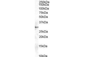Image no. 1 for anti-Dimethylarginine Dimethylaminohydrolase 2 (DDAH2) (C-Term) antibody (ABIN374148) (DDAH2 antibody  (C-Term))