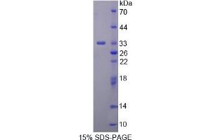 Image no. 1 for WNK Lysine Deficient Protein Kinase 1 (WNK1) (AA 1954-2231) protein (His tag) (ABIN6238103) (WNK1 Protein (AA 1954-2231) (His tag))