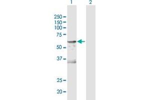 Western Blot analysis of CA9 expression in transfected 293T cell line by CA9 MaxPab polyclonal antibody. (CA9 antibody  (AA 1-459))