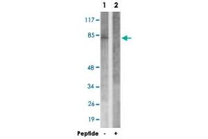 Western blot analysis of extracts from A-549 cells, using RAD17 polyclonal antibody . (RAD17 antibody)