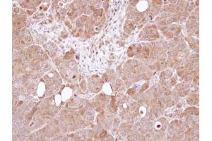 IHC-P Image Immunohistochemical analysis of paraffin-embedded SW480 xenograft, using AHA-1 , antibody at 1:100 dilution. (AHSA1 antibody  (Center))