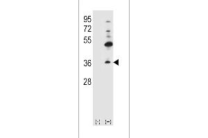 Western blot analysis of GJB4 using rabbit polyclonal GJB4 Antibody (H105. (GJB4 antibody  (N-Term))