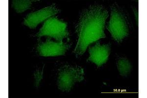 Immunofluorescence of monoclonal antibody to ARRB2 on HeLa cell. (Arrestin 3 antibody  (AA 300-409))
