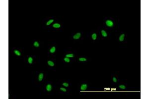Immunofluorescence of purified MaxPab antibody to RAD18 on HeLa cell. (RAD18 antibody  (AA 1-495))