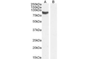 ABIN5539909 (1µg/ml) staining of Rat Testes lysate (A) + Peptide (B) (35µg protein in RIPA buffer). (STRA6 antibody  (C-Term))