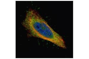 ICC/IF Image Confocal immunofluorescence analysis (Olympus FV10i) of paraformaldehyde-fixed HeLa, using Filamin B, antibody (Green) at 1:500 dilution. (FLNB antibody  (N-Term))