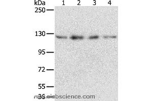 Western blot analysis of Huvec, hepg2, 293T and A549 cell, using RBM5 Polyclonal Antibody at dilution of 1:500 (RBM5 antibody)