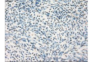 Immunohistochemical staining of paraffin-embedded colon tissue using anti-MAP2K1 mouse monoclonal antibody. (MEK1 antibody)