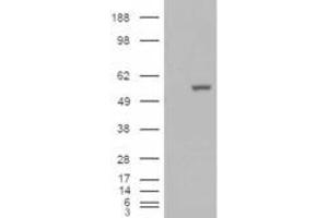 HEK293 overexpressing ALDH1A1 (ABIN5493687) and probed with ABIN184581 (mock transfection in first lane).