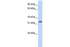 WB Suggested Anti-SIAH2 Antibody Titration: 0. (SIAH2 antibody  (N-Term))