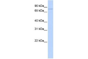 WB Suggested Anti-ZBTB39 Antibody Titration:  0. (ZBTB39 antibody  (Middle Region))