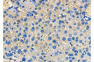 anti-Serum Amyloid A 4 (SAA4) (C-Term) antibody