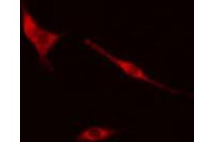 ABIN6274299 staining Hela cells by IF/ICC. (COPS2 antibody  (Internal Region))
