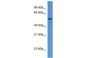 WB Suggested Anti-HARS AntibodyTitration: 1. (HARS1/Jo-1 antibody  (N-Term))