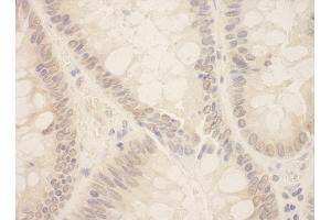 Immunohistochemistry (IHC) image for anti-Zinc Finger E-Box Binding Homeobox 2 (ZEB2) (AA 750-800) antibody (ABIN7448878)