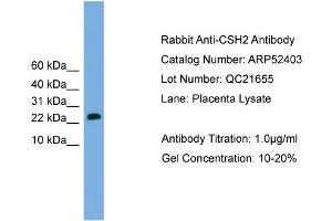 WB Suggested Anti-CSH2  Antibody Titration: 0. (CSH1 antibody  (Middle Region))