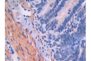 IHC-P analysis of Rat Intestine Tissue, with DAB staining. (Endoglin antibody  (AA 26-136))
