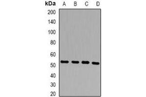 Western blot analysis of Presenilin 2 expression in HepG2 (A), Hela (B), mouse liver (C), rat liver (D) whole cell lysates. (Presenilin 2 antibody)