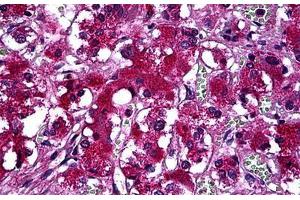 Human Adrenal: Formalin-Fixed, Paraffin-Embedded (FFPE) (SYT1 antibody  (AA 1-423))