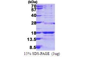 SDS-PAGE (SDS) image for Small Nuclear Ribonucleoprotein D3 Polypeptide 18kDa (SNRPD3) (AA 1-126) protein (His tag) (ABIN667958)