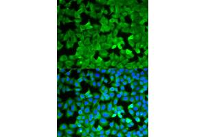 Immunofluorescence analysis of A549 cells using ASNS antibody.