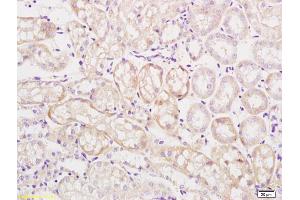 Formalin-fixed and paraffin embedded mouse kidney labeled with Rabbit Anti Mitofusin 2/MFN2 Polyclonal Antibody, Unconjugated (ABIN682528) at 1:200 followed by conjugation to the secondary antibody and DAB staining (MFN2 antibody  (AA 1-120))