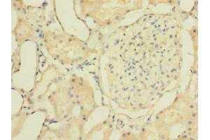 Immunohistochemistry of paraffin-embedded human kidney tissue using ABIN7176509 at dilution of 1:100 (ZNF77 antibody  (AA 51-369))