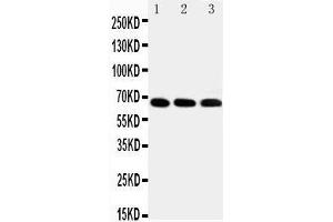 Anti-IRAKM antibody,  Western blotting Lane 1: HELA Cell Lysate Lane 2: JURKAT Cell Lysate Lane 3: HUT102 Cell Lysate (IRAK3 antibody  (C-Term))