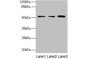 Western blot All lanes: ACSBG2 antibody at 4 μg/mL Lane 1: A431 whole cell lysate Lane 2: K562 whole cell lysate Lane 3: A549 whole cell lysate Secondary Goat polyclonal to rabbit IgG at 1/10000 dilution Predicted band size: 75, 69, 54, 52 kDa Observed band size: 52 kDa (ACSBG2 antibody  (AA 301-600))