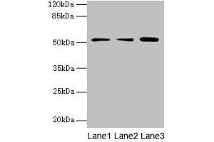 Western blot All lanes: ACSBG2 antibody at 4 μg/mL Lane 1: A431 whole cell lysate Lane 2: K562 whole cell lysate Lane 3: A549 whole cell lysate Secondary Goat polyclonal to rabbit IgG at 1/10000 dilution Predicted band size: 75, 69, 54, 52 kDa Observed band size: 52 kDa