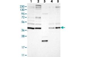 Western blot analysis of Lane 1: RT-4, Lane 2: U-251 MG, Lane 3: Human Plasma, Lane 4: Liver, Lane 5: Tonsil with FRYL polyclonal antibody  at 1:250-1:500 dilution. (FRY-Like antibody)