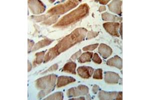 Immunohostochemistry analysis in formalin fixed and paraffin embedded human skeletal muscle tissue reacted with MMAA Antibody (N-term) followed by peroxidase conjugation of the secondary antibody and DAB staining. (MMAA antibody  (N-Term))