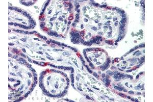 SIN3A antibody was used for immunohistochemistry at a concentration of 5. (SIN3A antibody  (N-Term))